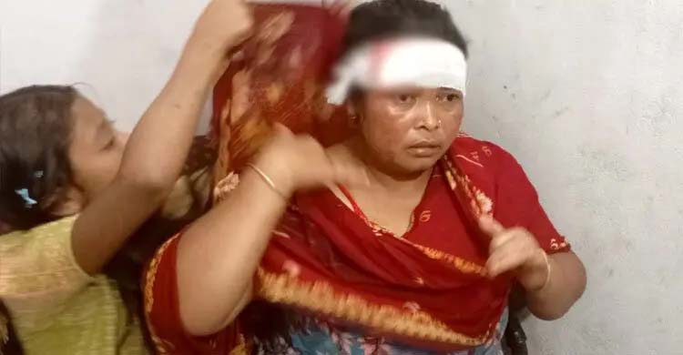 কিস্তির টাকা না পেয়ে গ্রাহকের মাথা ফাটালেন ব্র্যাকের কর্মী
