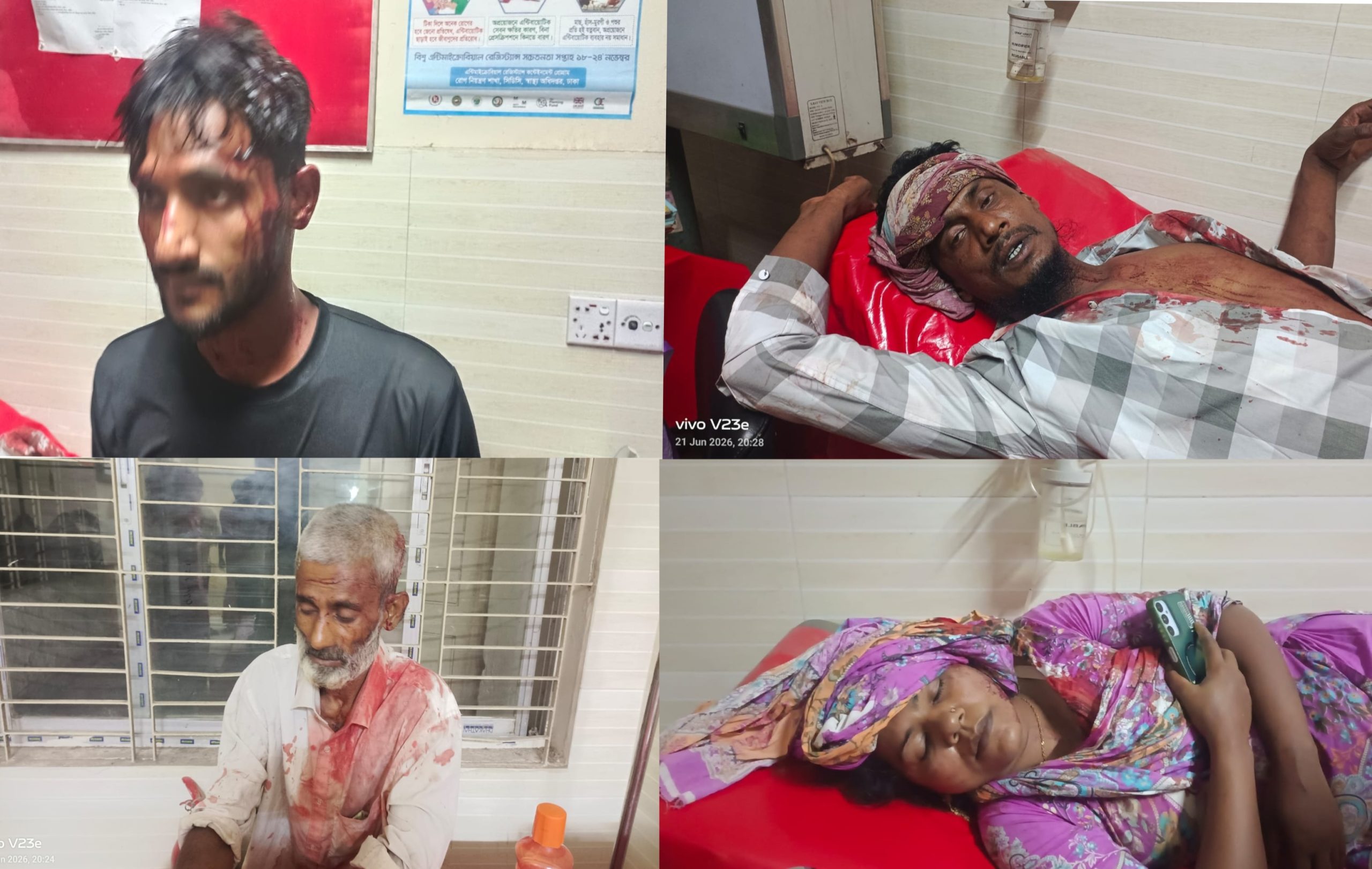 তিতাসে তুচ্ছ ঘটনা নিয়ে মামা -ভাগিনার মধ্যে সংঘর্ষ, নারীসহ আহত-১০