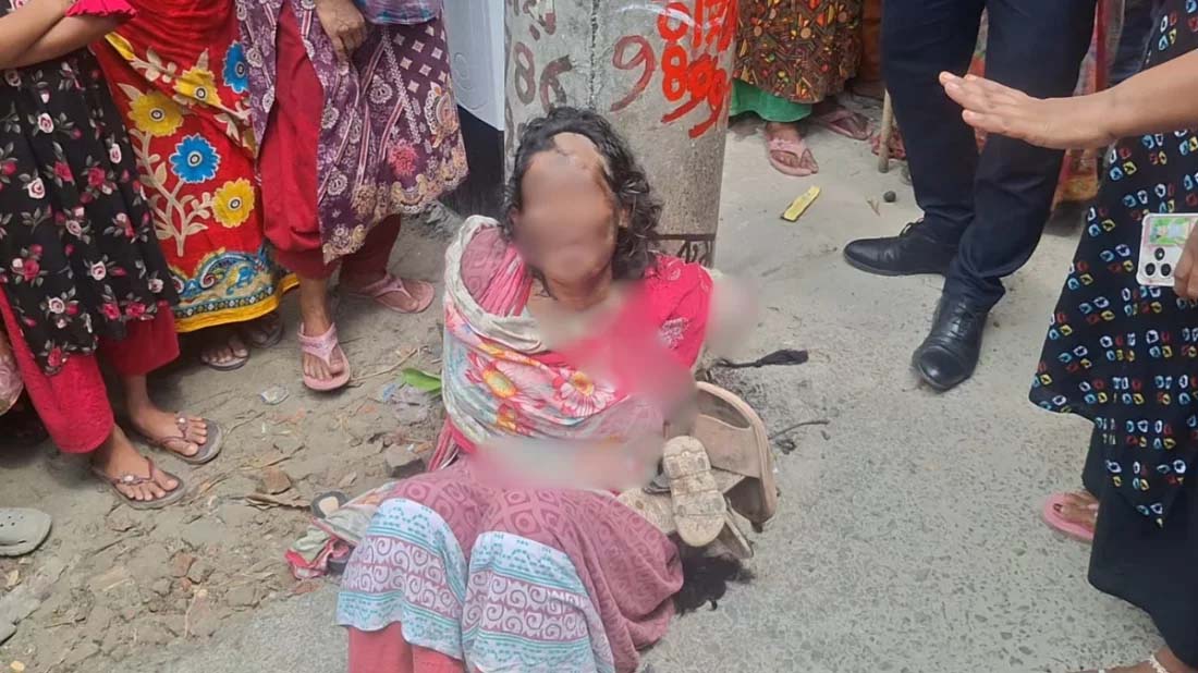 শরীয়তপুরে নারীকে খুঁটিতে বেঁধে মারধর, হাসপাতালে ভর্তি